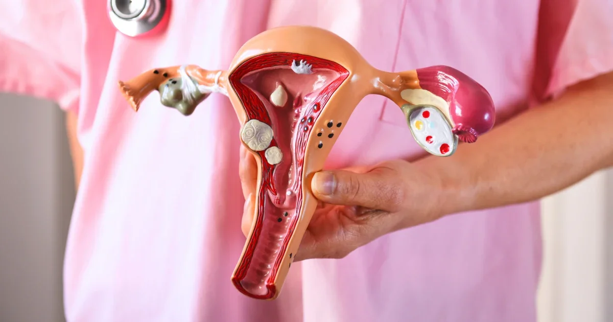 Doctor Outlines Cervical Cancer Symptoms and Prevention