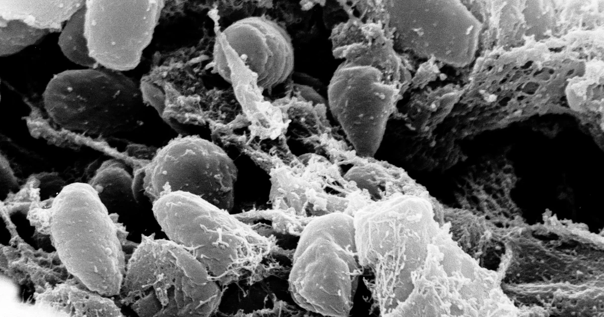 Featured image for California Resident Contracts Plague Likely from Flea Bite at Lake Tahoe