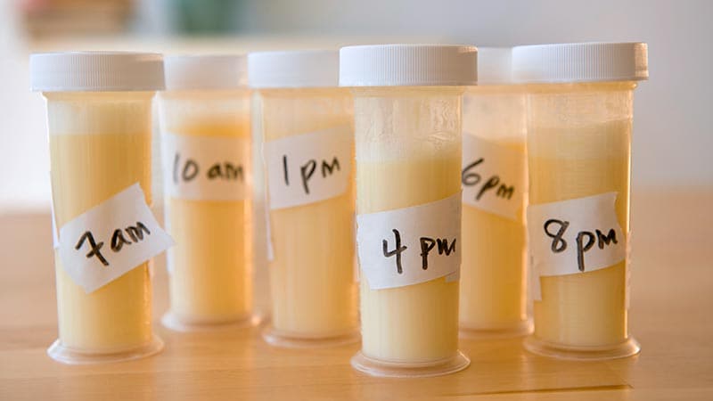 Featured image for Revolutionary Breakthrough: Breast Milk as a Game-Changer in Early Breast Cancer Detection
