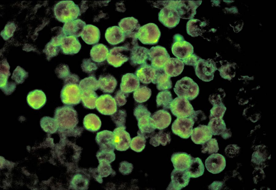 Featured image for Fatal Brain-Eating Amoeba Claims Lives in Arkansas