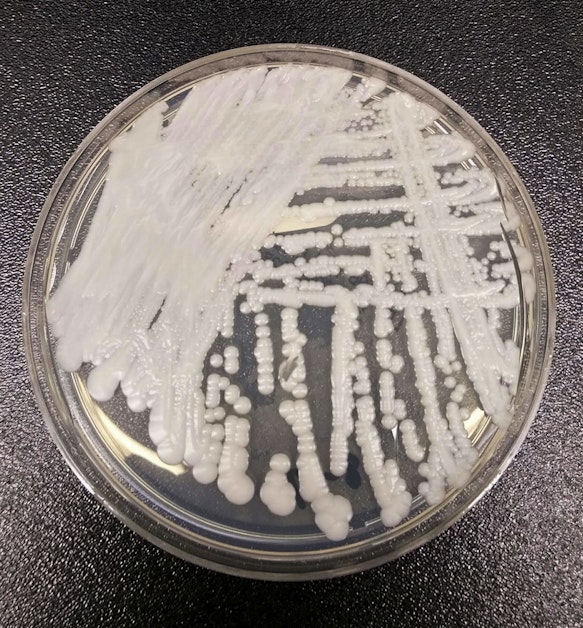 "Deadly Fungus Outbreak Hits Seattle Hospital: What You Need to Know"