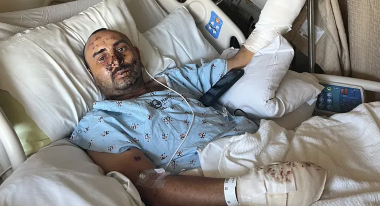 Featured image for Gardener's Hand and Vision Lost in Torrance Firework Accident