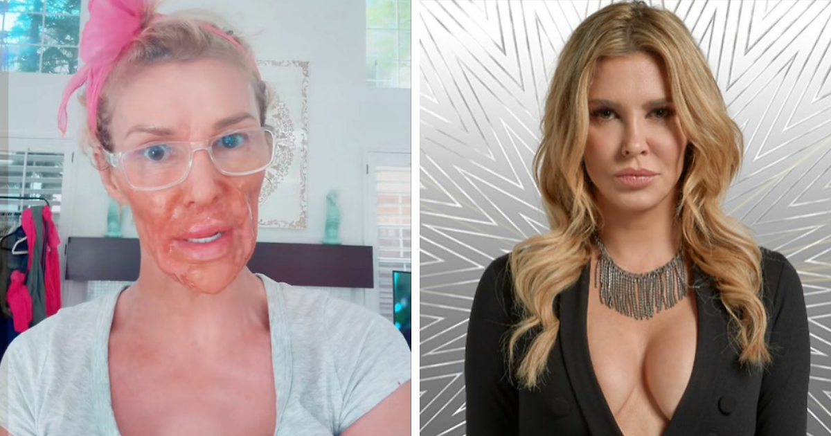 Featured image for Brandi Glanville Unveils New Smile After $130K Health Fight and Parasite Battle