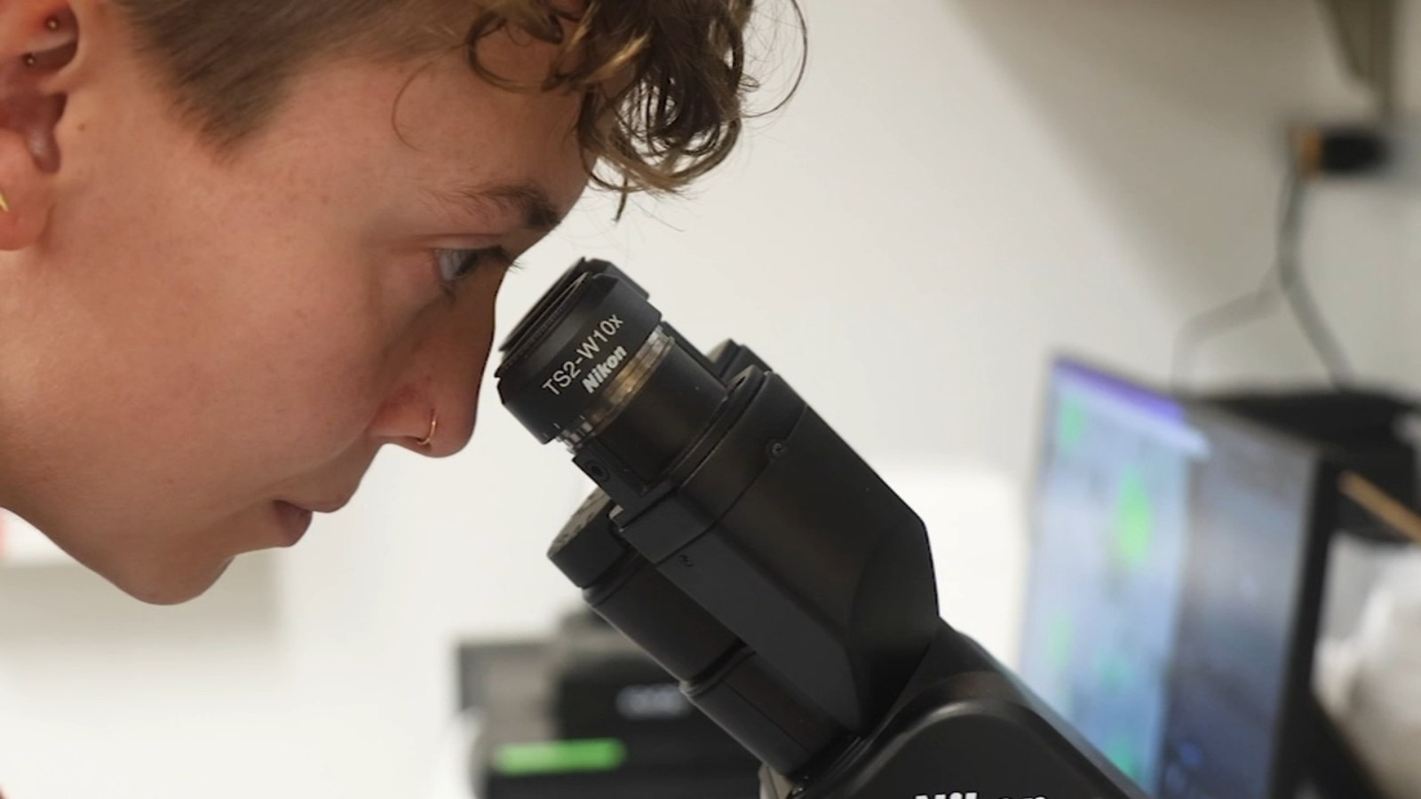 Featured image for Duke Researchers Uncover New Origins of Lung Cancer, Opening Doors for Innovative Treatments