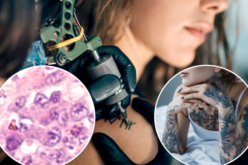 "Study Suggests Tattoos May Be Linked to Lymphoma"
