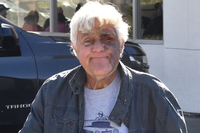 Featured image for Jay Leno Suffers Injuries After Hill Fall in Search of Chicken Parmesan