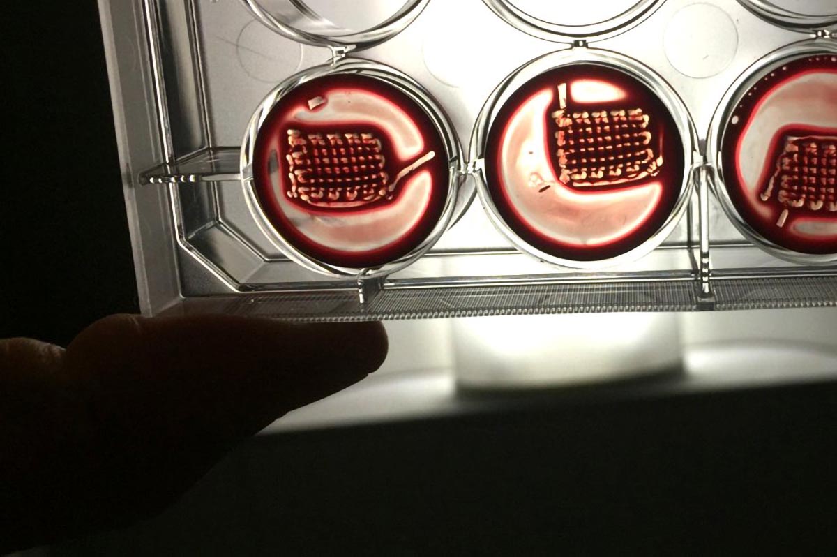 Revolutionary Technique Turns Blood into Bone-Healing Superpower
