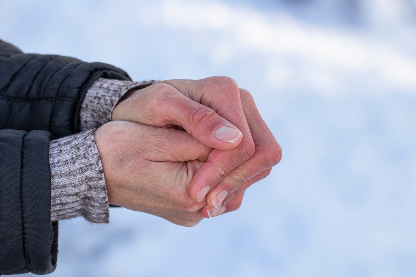 "Breakthrough Drug Aurlumyn Offers Hope for Frostbite Amputation Prevention"