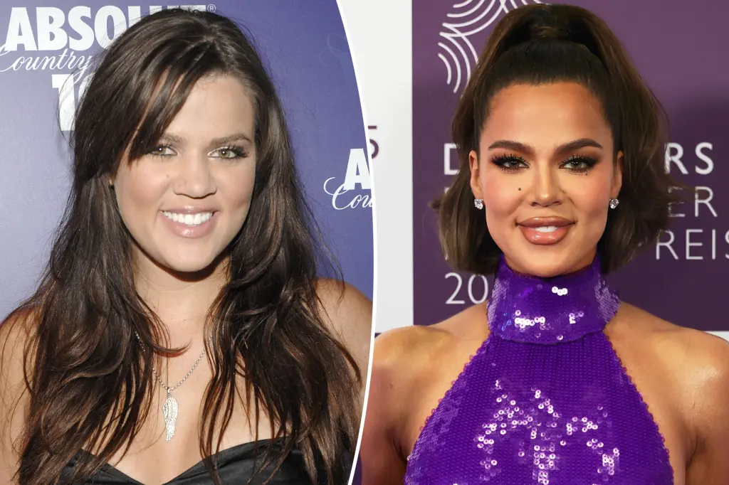 Featured image for Khloé Kardashian Opens Up About Her Complete Cosmetic Surgery Journey