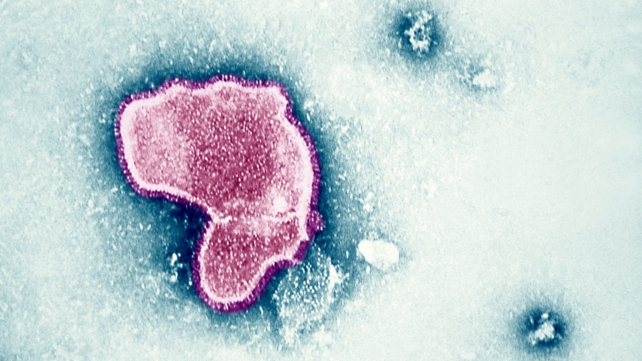 CDC warns of rising RSV cases in Southeastern US, particularly Florida