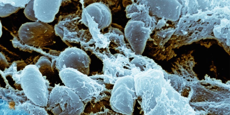 Featured image for "Deadly Kamikaze Bacteria Unleash Lethal Toxins in Explosive Bursts"