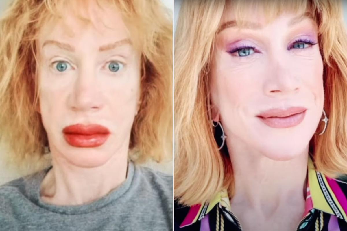 Featured image for Kathy Griffin's Startling Transformation: Lips Tattoo Leaves Friends Stunned