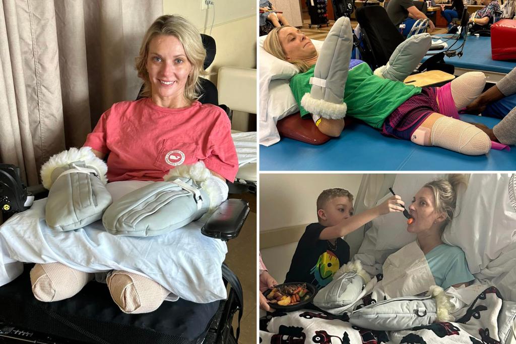 Woman Finds Peace and Gratitude After Losing Limbs: A Story of Resilience and Community Support