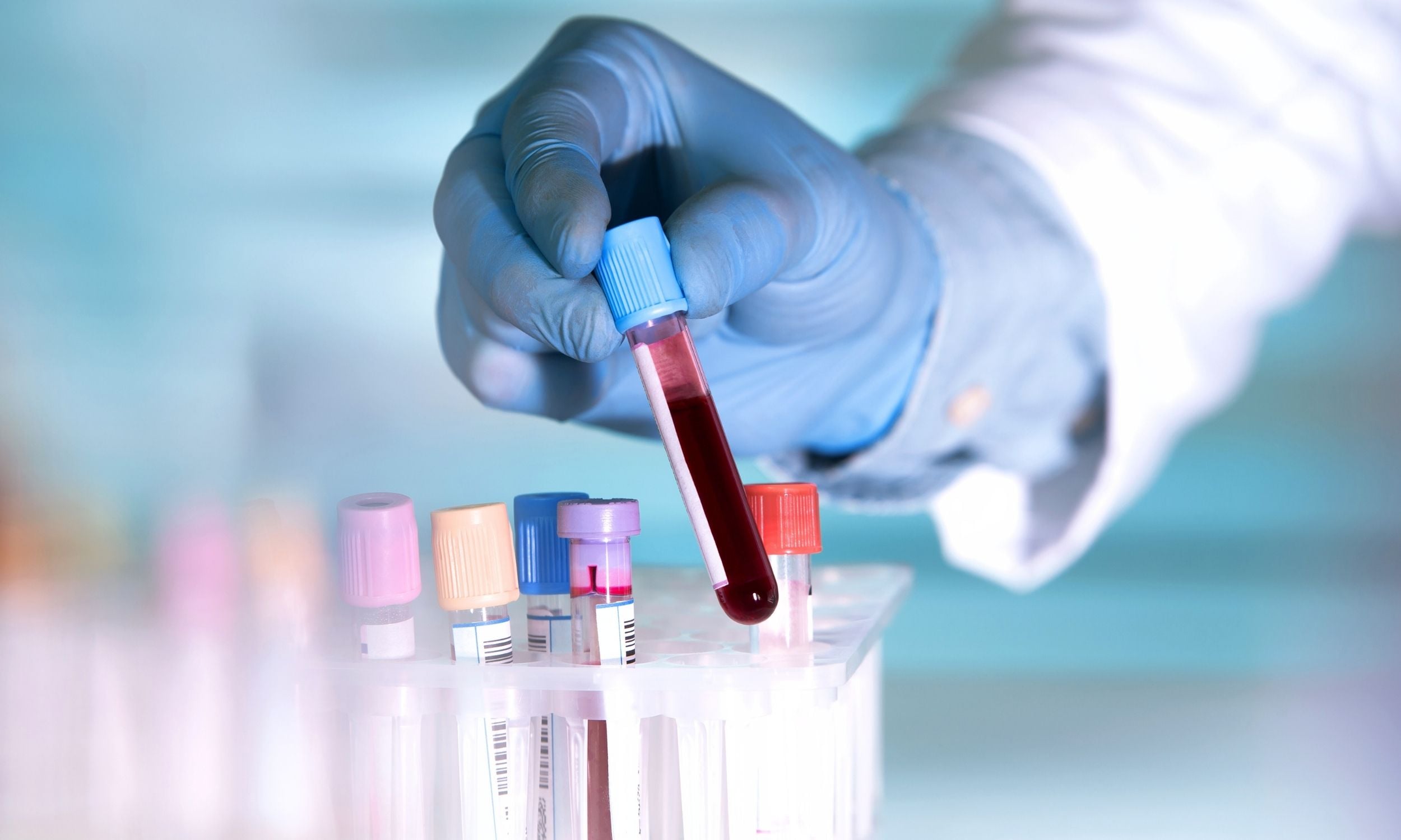 Featured image for Revolutionary Blood Test Detects Cancer Years Before Symptoms