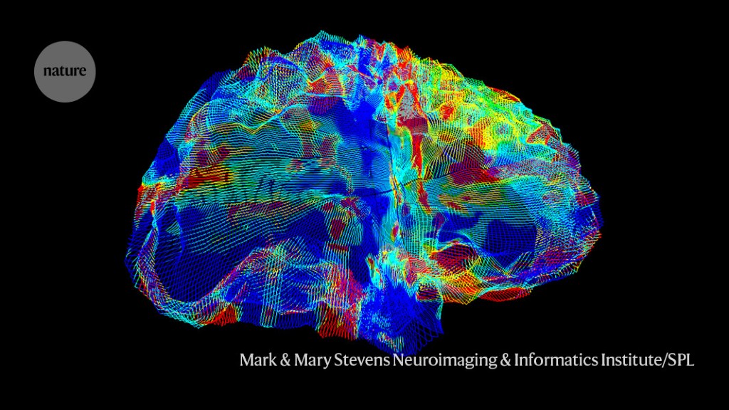 "Breakthrough AI Identifies Alzheimer's Genes through Brain Scans"