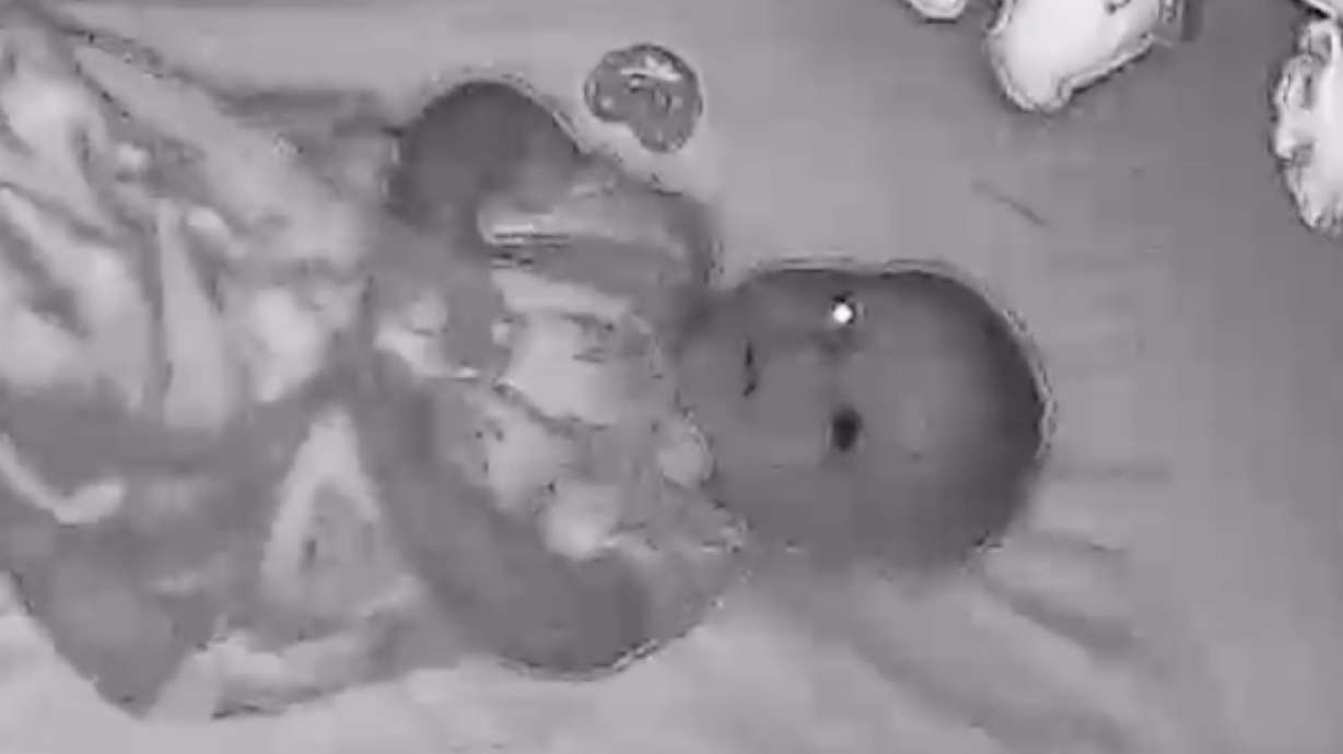 "Baby Monitor's Black Eye Leads to Early Cancer Detection, Saving Murray Infant's Life"