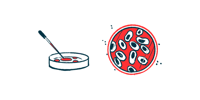 Advancements in Parkinson's cell therapies and treatment research