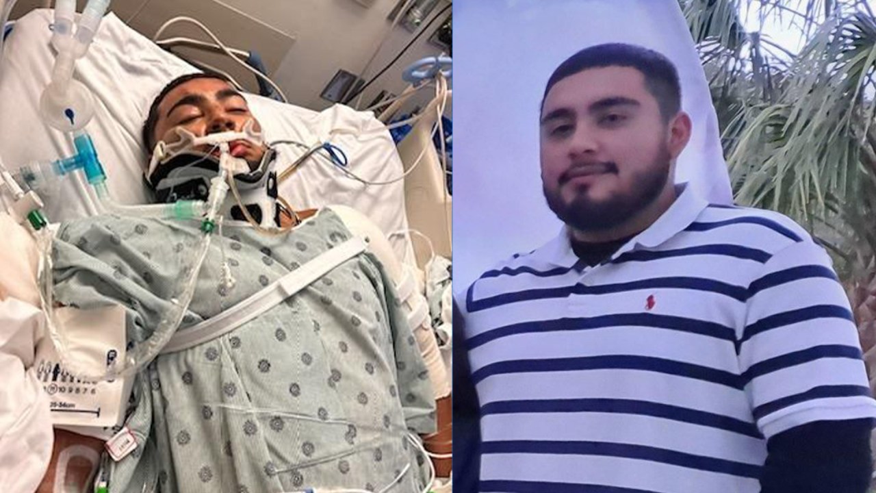 Tragic Train Crash in Florida Leaves Sole Survivor with Brain Bleed