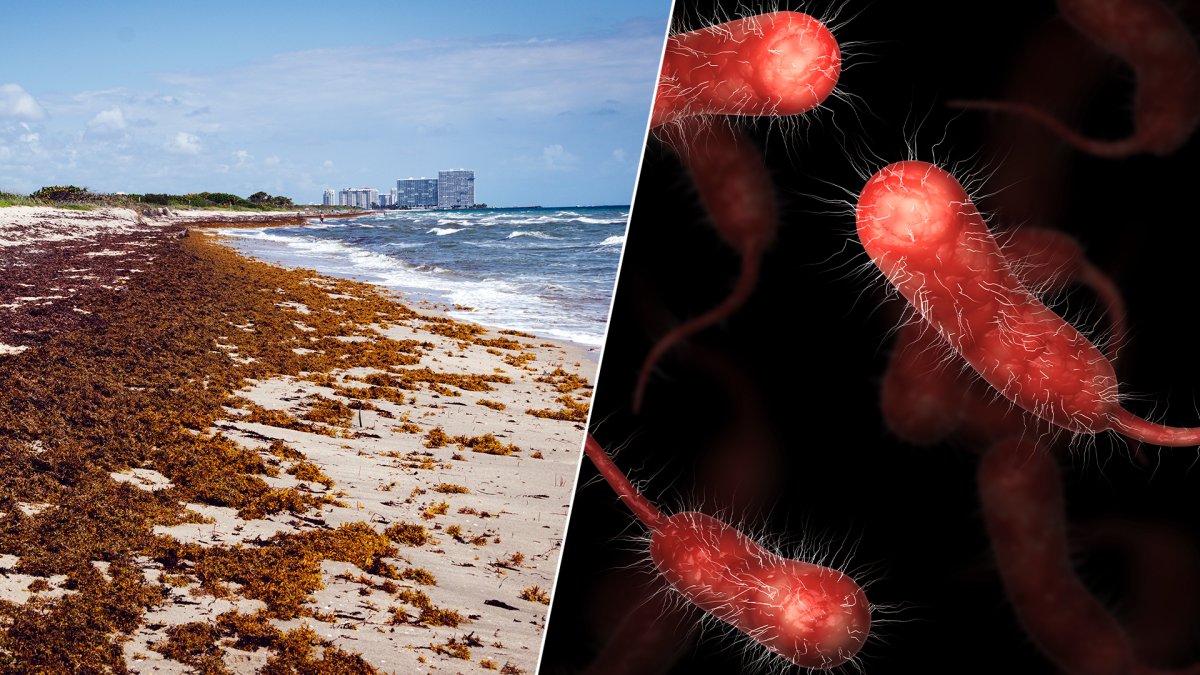 Featured image for "Deadly 'Flesh-Eating' Bacteria Claims Lives in Florida's Shellfish and Seawater"