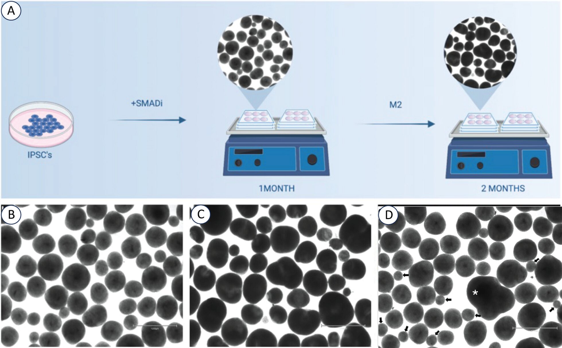 Featured image for "Brain Overgrowth Linked to Autism Severity, Study Finds"