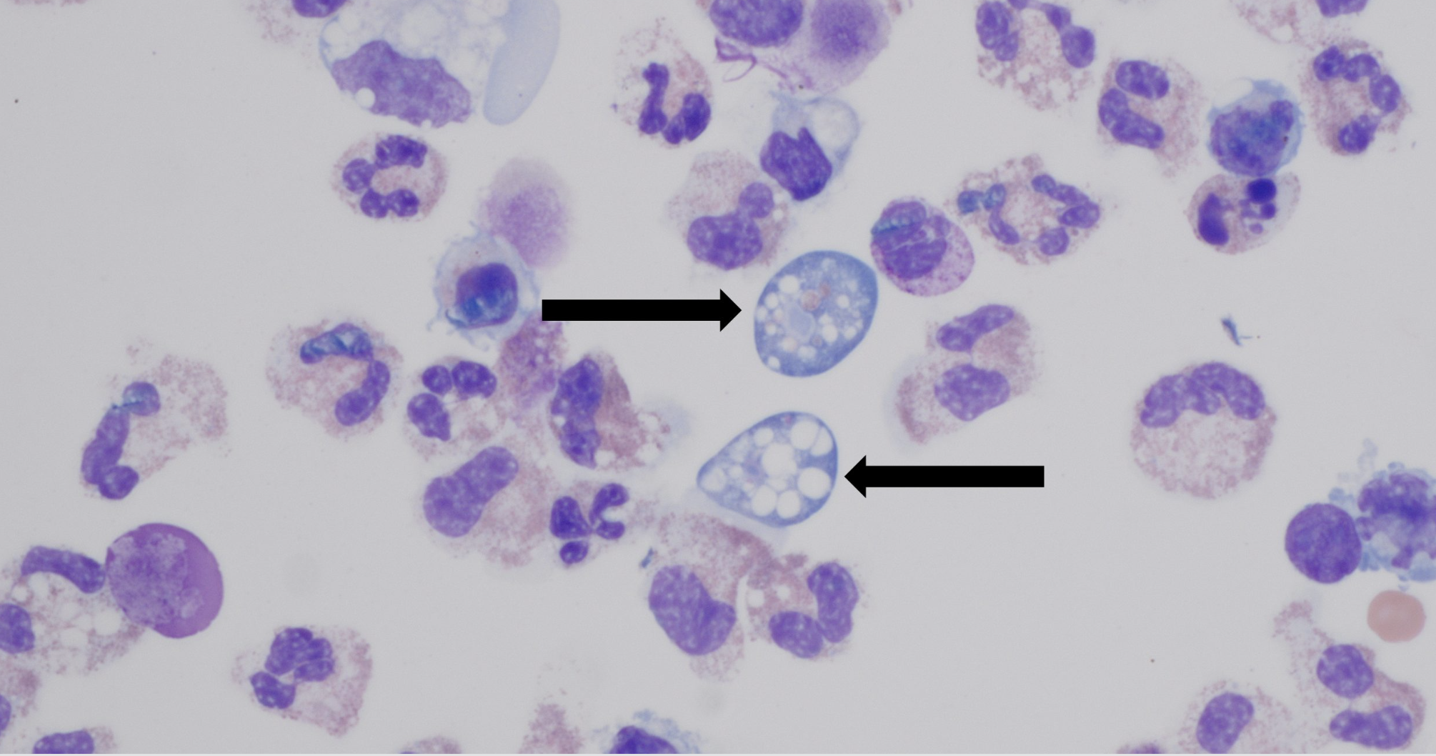 Featured image for Rare brain-eating amoeba cases linked to water activities at Lake of the Ozarks and Queensland