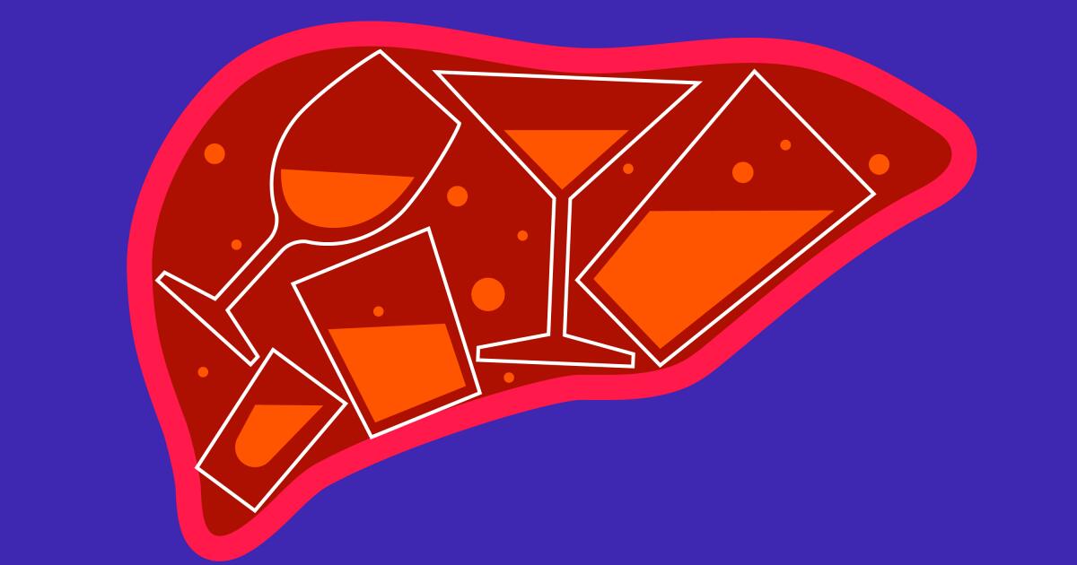 Featured image for Rising Alcohol Use Among Women Linked to Increased Liver Disease