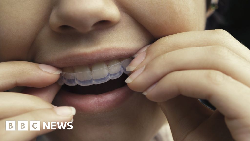 Featured image for SmileDirectClub, Orthodontics Company, Abruptly Closes Doors