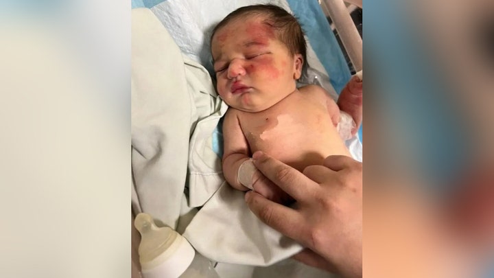 Featured image for Stray Dog Rescues Abandoned Baby Girl Found in Lebanon's Garbage Bag