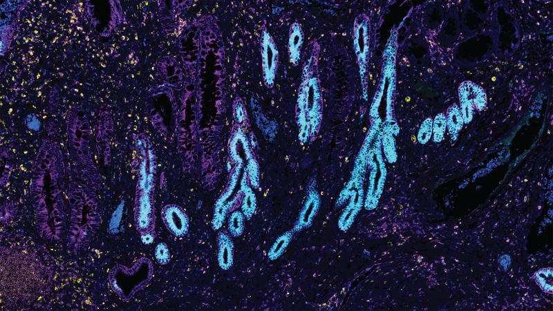 Featured image for Breakthrough Cell Atlas Maps Every Human Cell Type