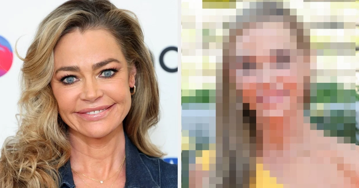 Denise Richards Reveals Night-and-Day Facelift Transformation