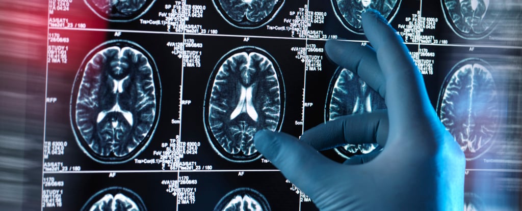 Featured image for "The Lingering Effects of COVID: Unveiling Brain Injuries, Cognitive Issues, and Smell Loss"