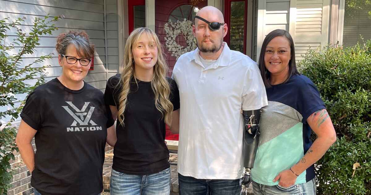 Featured image for Man Receives Groundbreaking Whole Eye Transplant After Electric Shock