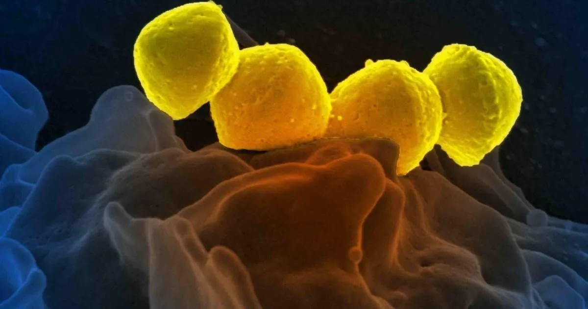 Featured image for Rising Threat: The Surge of Deadly Streptococcal Infections in Japan