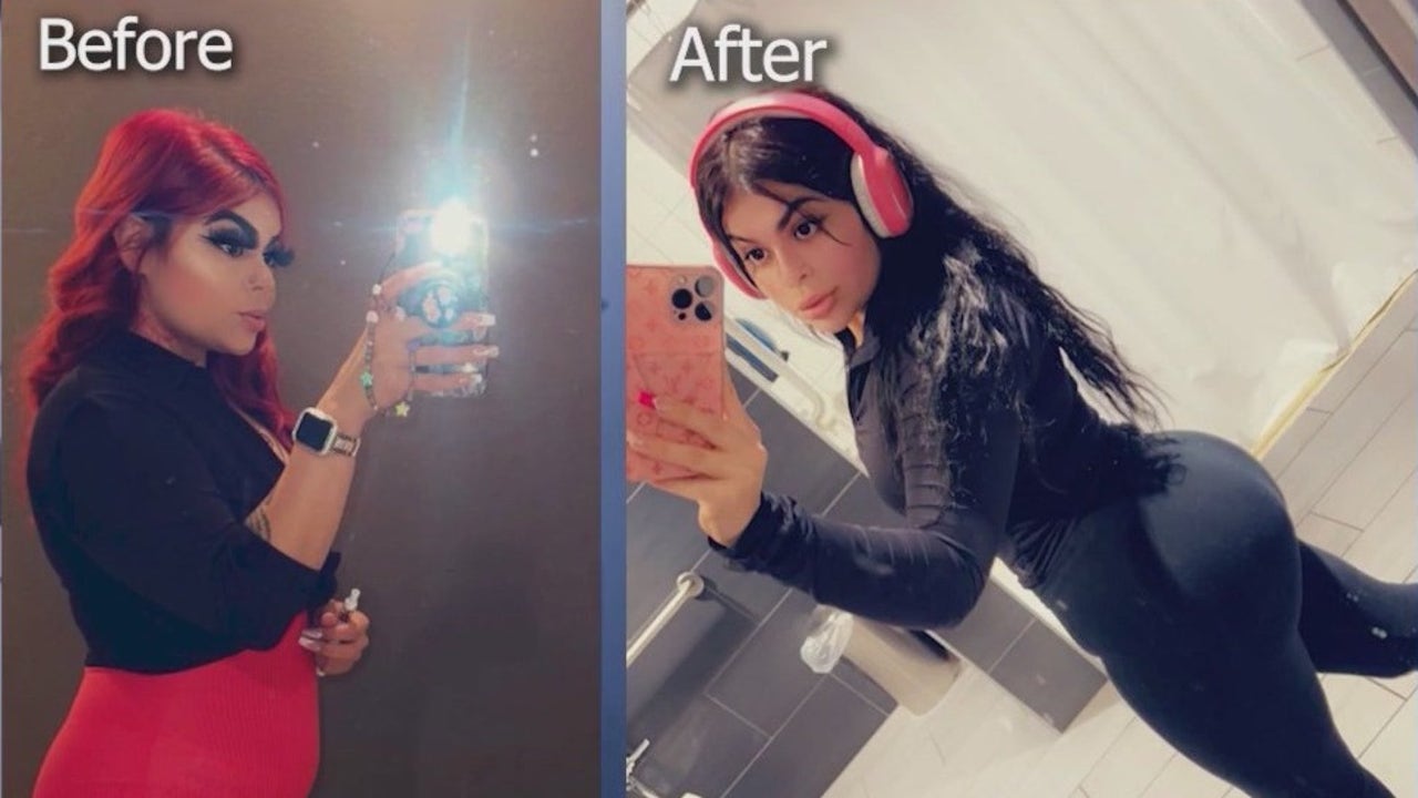 Featured image for Dangerous Plastic Surgery in Mexico: Phoenix Woman's Near-Death Experience