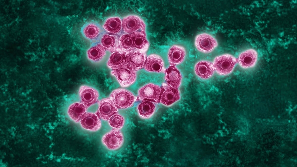 Featured image for Shingles on the Rise: Exploring the Surge in Younger Adults