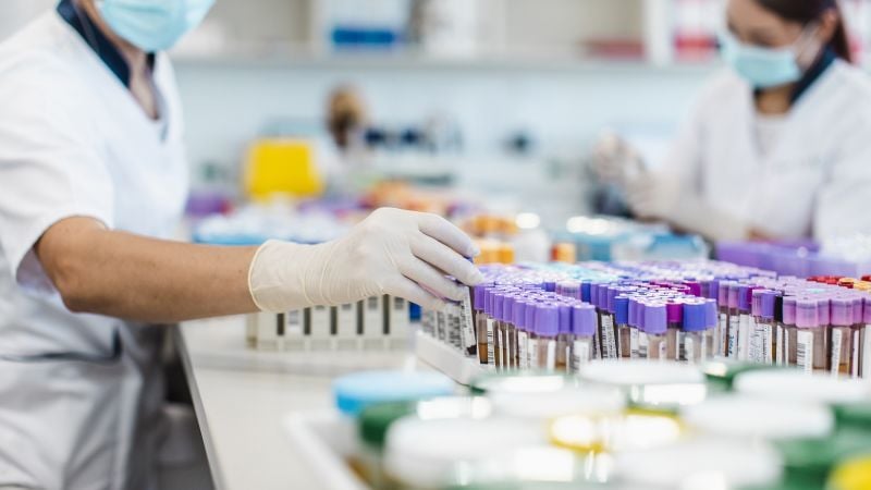 Featured image for "Newly Discovered Gene Linked to Obesity"