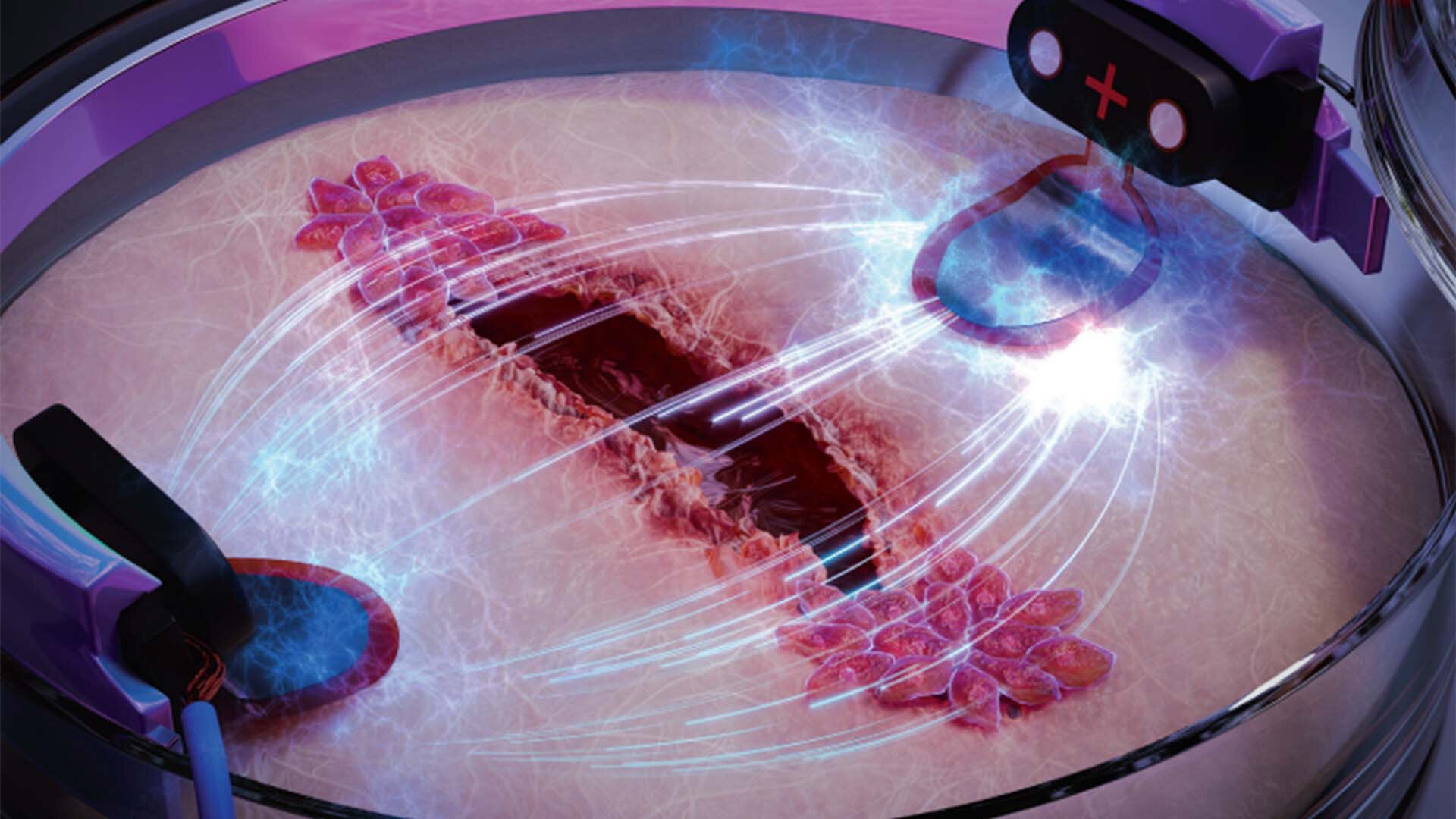 Featured image for Electricity speeds up wound healing by three times, says new study.