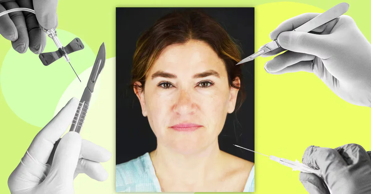 90-Minute Minimally Invasive Makeover Delivers Facelift-Like Results