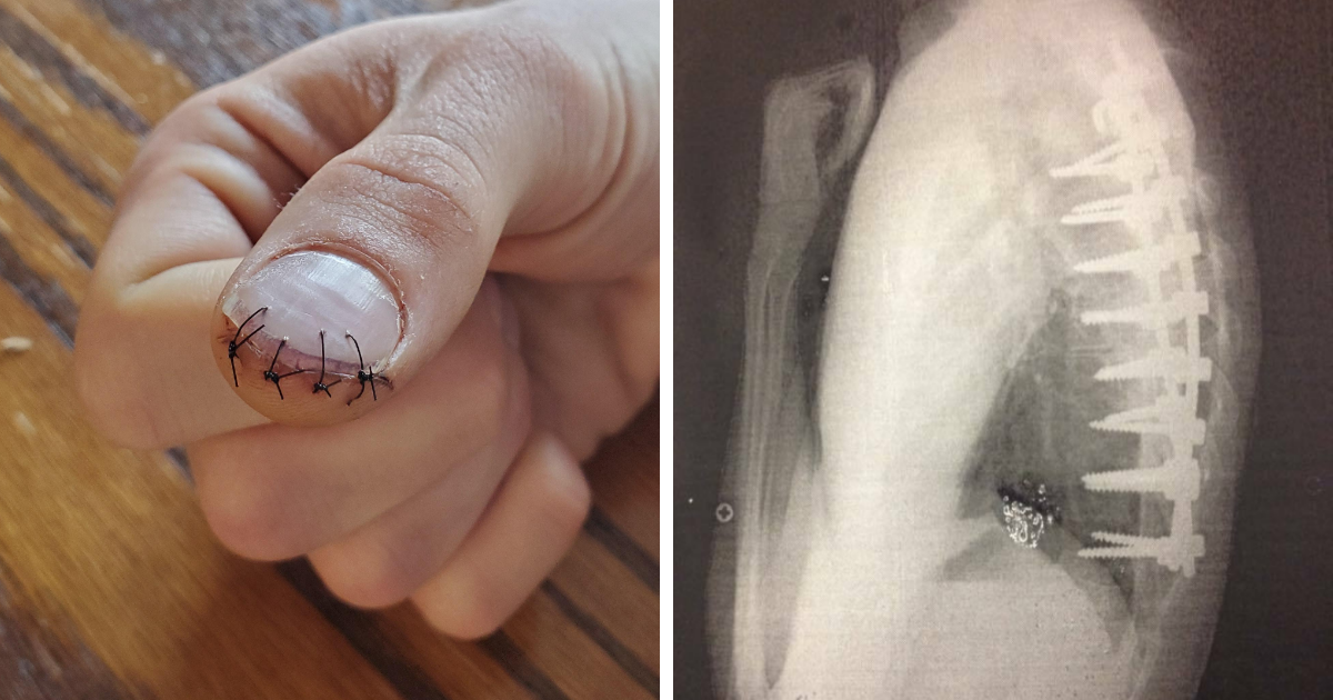 Featured image for 80 Shocking Moments That Stunned Medical Experts