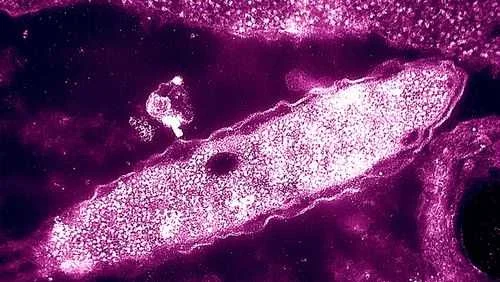 NYC Legionnaires' Disease Outbreak Expands to Over 100 Cases and 4 Deaths