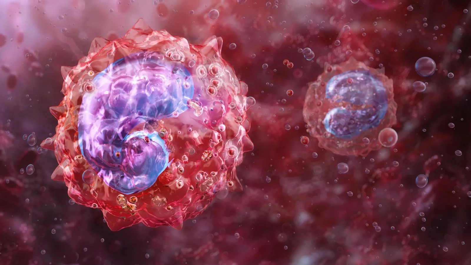 New Monocyte State Tied to Long COVID Fatigue and Breathing Issues