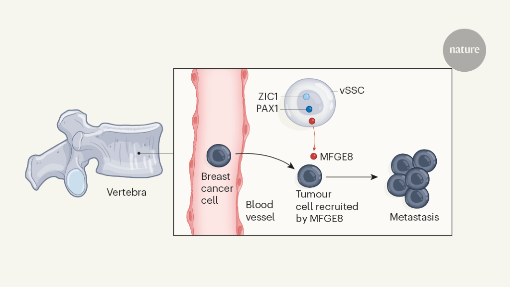 Featured image for Unraveling the Link Between Stem Cells and Tumor Cell Attraction in Vertebrae