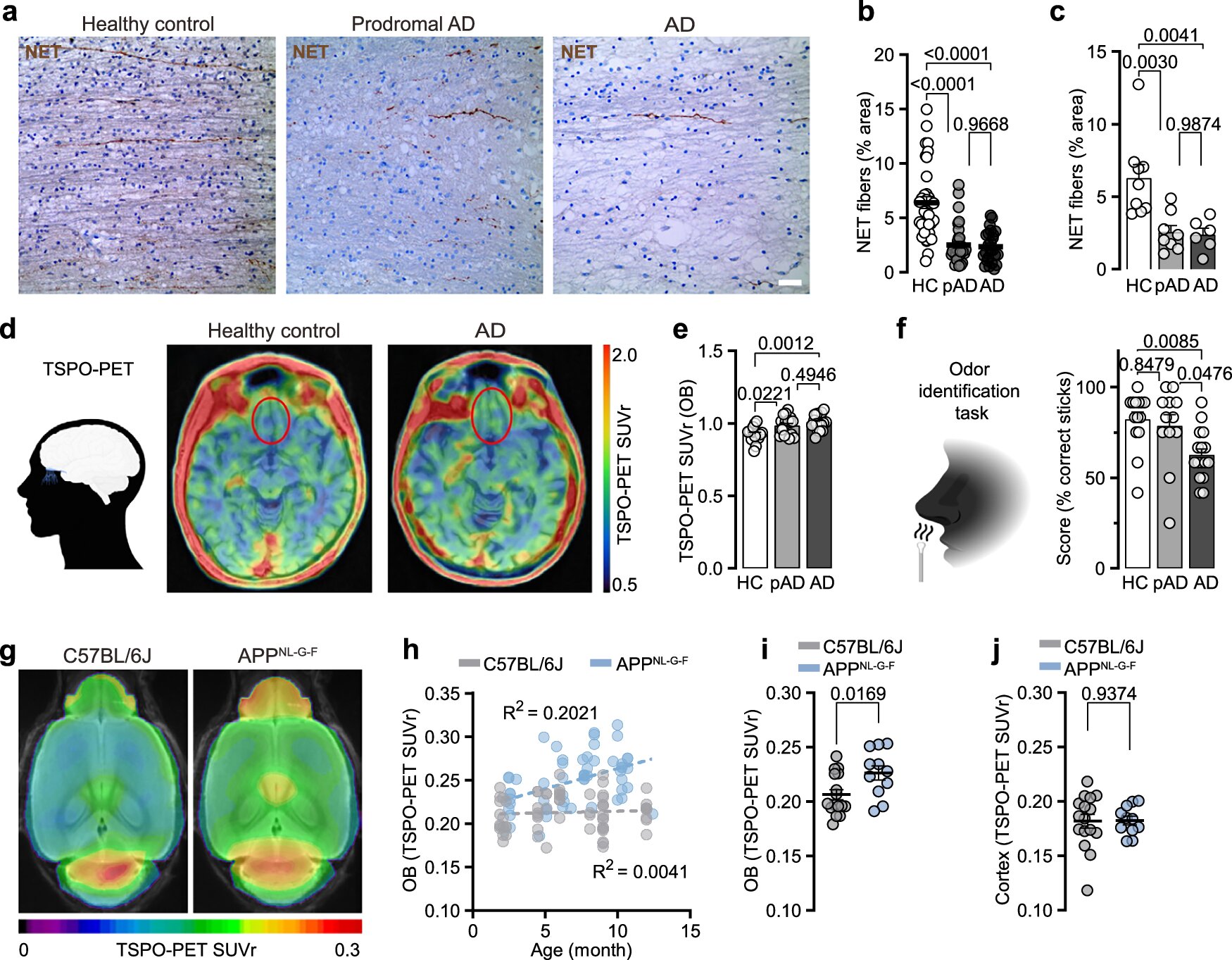 Featured image for Brain's Immune Response and Olfactory Loss as Early Signs of Alzheimer’s