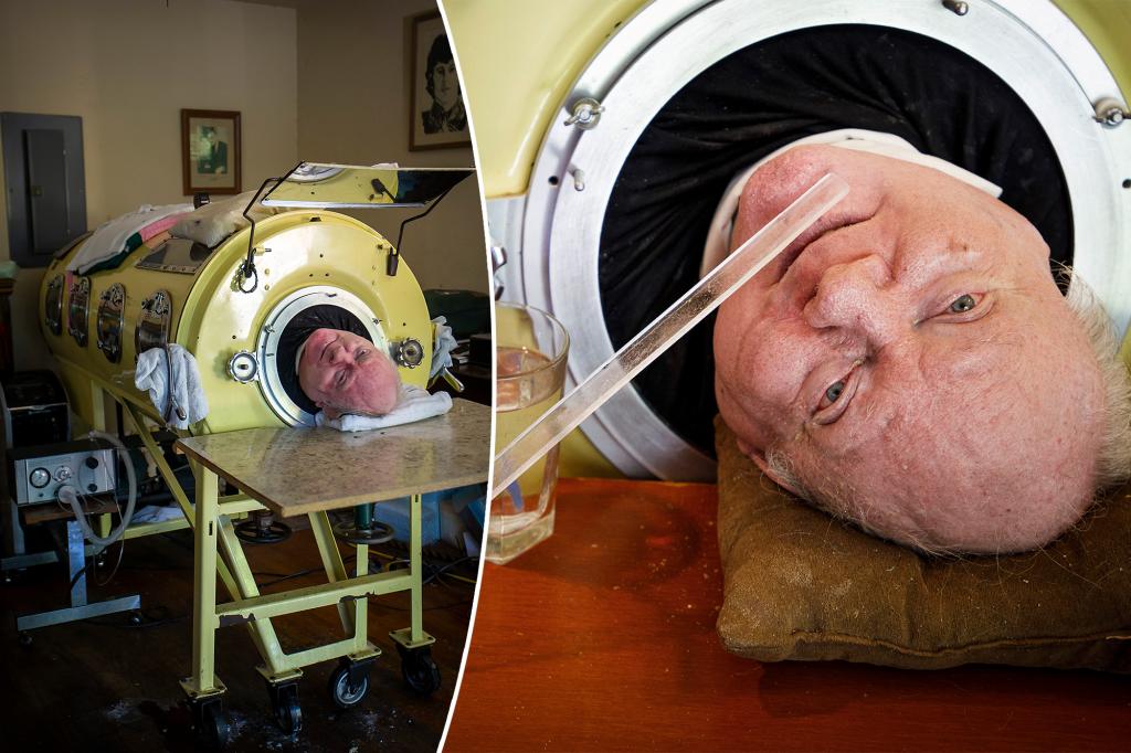 Featured image for "Polio Survivor Paul Alexander, Who Lived in Iron Lung for 70 Years, Passes Away at 78"