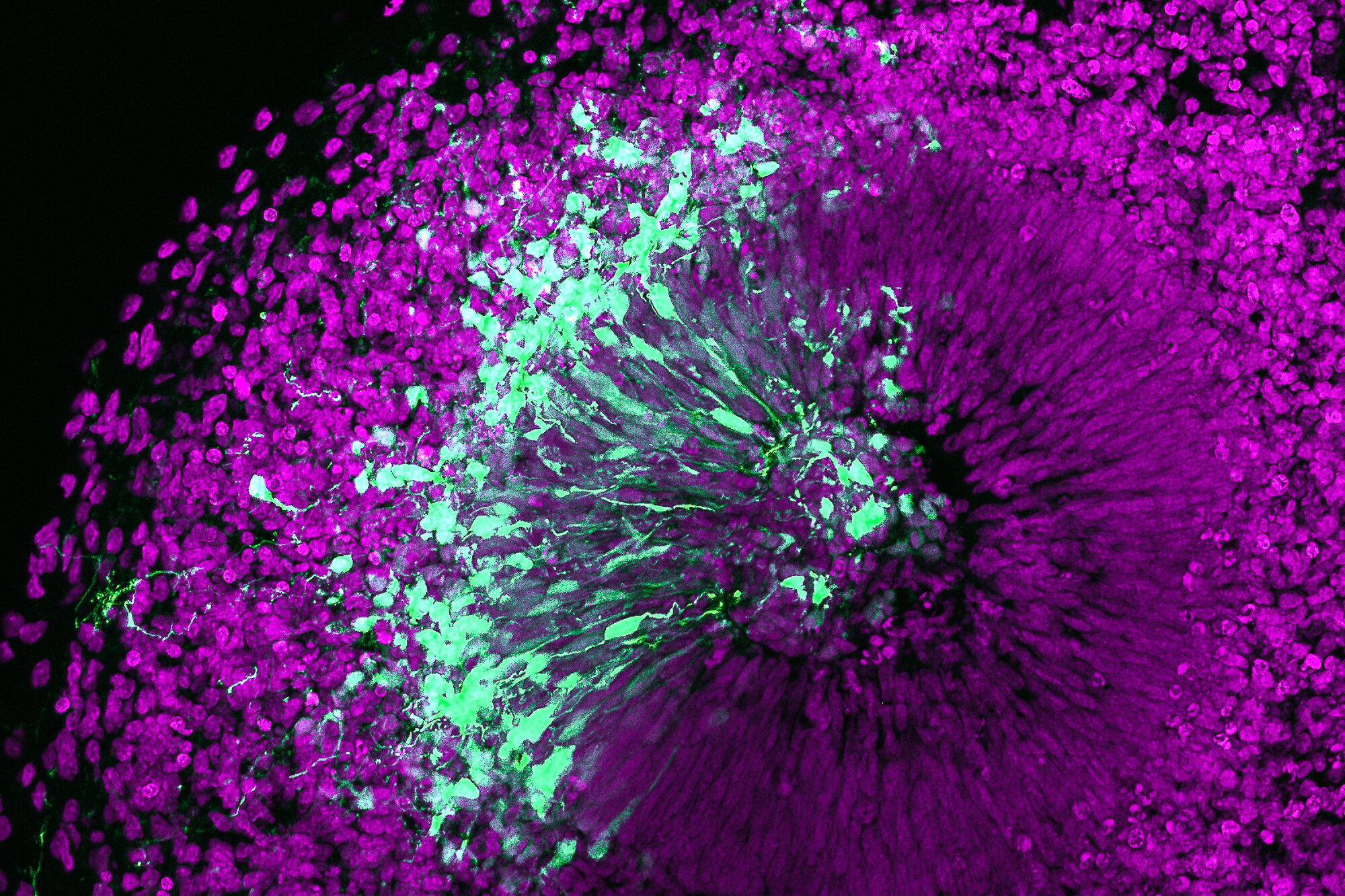 Featured image for "Key Factor in Human Brain Expansion Identified Through Organoids Research"