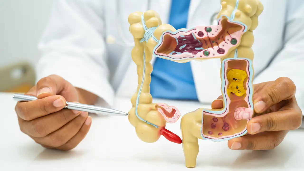 Featured image for Rising Appendix Cancer Cases in Young Adults: Key Signs to Watch For