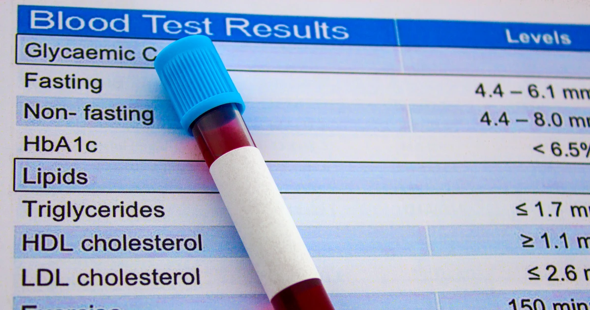 Gene Editing Drug Halves Harmful Cholesterol in Early Trials