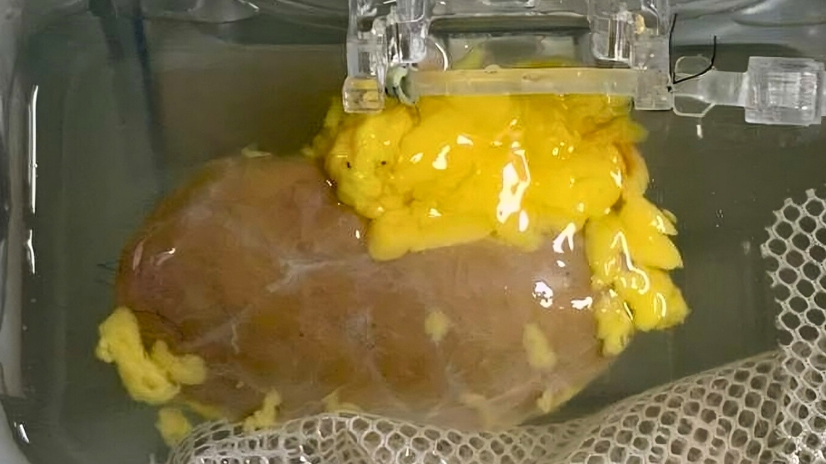 Featured image for Scientists Develop Universal Kidney Compatible with All Blood Types