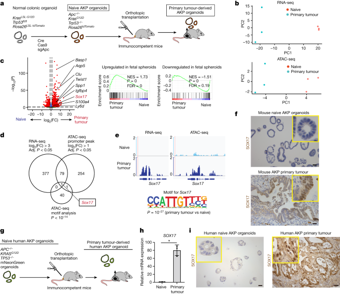 Featured image for "SOX17's Role in Immune Evasion of Colorectal Adenomas and Cancers"