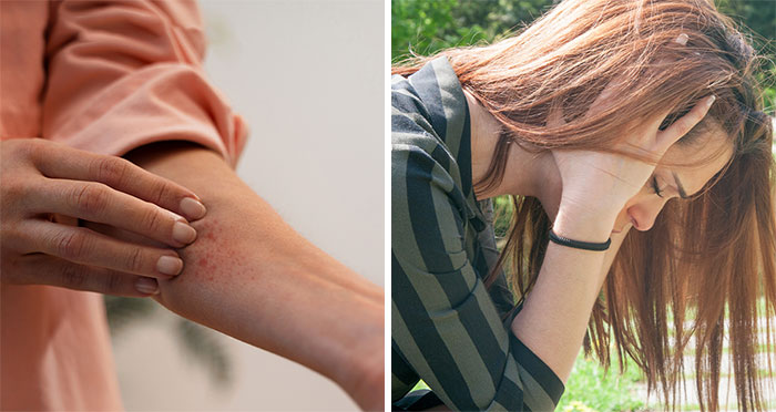 Featured image for Teen's Allergic Reaction Causes Explosive Room Incident